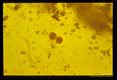 Oocysts, iodine stained and unstained in stool