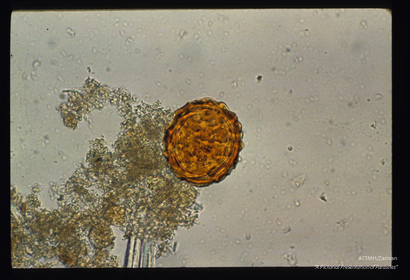 Egg in stool showing shell layers nicely.