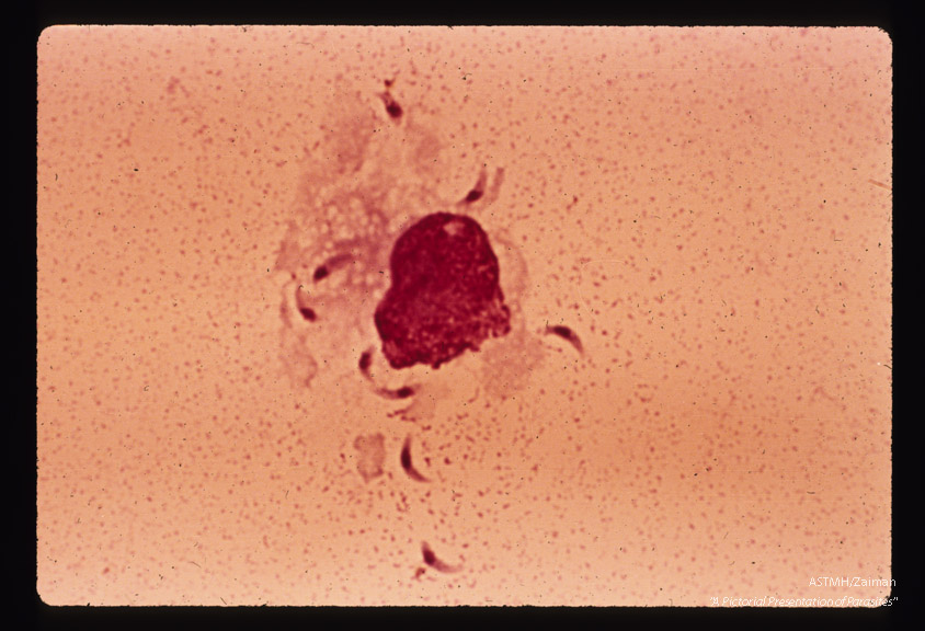 Trophic stages from rupturing cell in mouse peritoneal exudate.