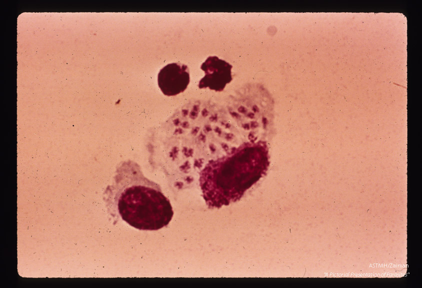 Trophic stages in a cell from mouse peritoneal fluid.