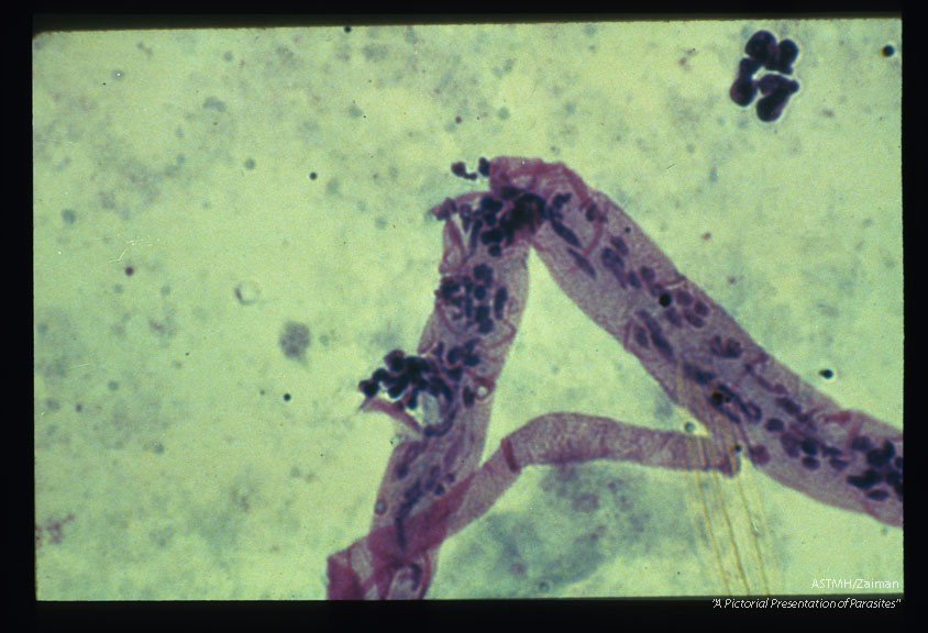 Giemsa stained damaged larva from A. gambiae midgut.