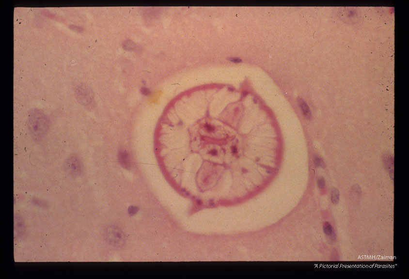 Larva in rabbit cerebrum.