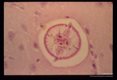 Larva in rabbit cerebrum.