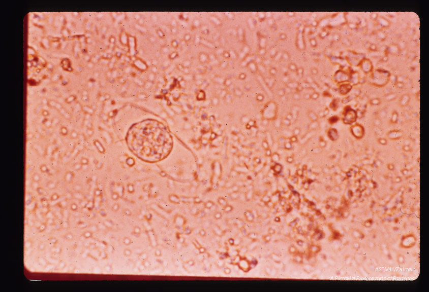 Oocyst with single protoplasmic mass.