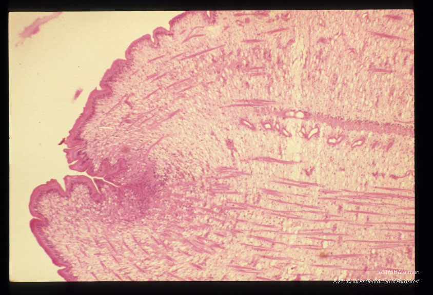 Multiple cross sections through the parasite at various magnifications are presented.