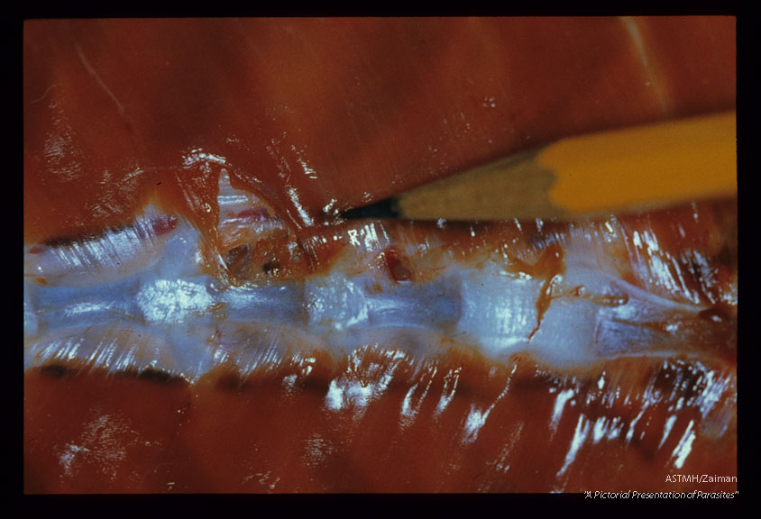 Hemorrhages and perforations along the vertebral column are present in a domestic dog infected 25 days earlier.