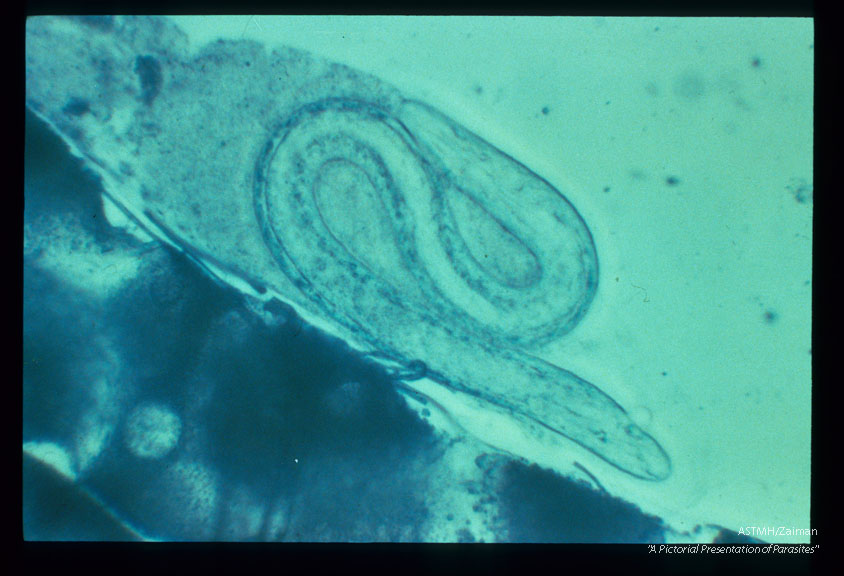 Phase contrast micrographs of developing larvae within the Malpighian tubules of A. trivittatus.