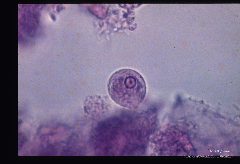 MIF stained trophozoites from a carrier.