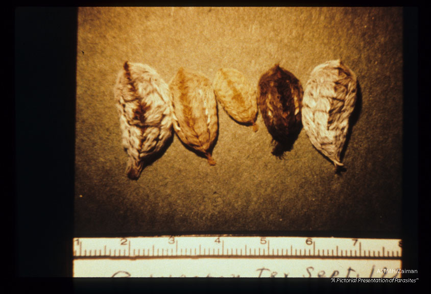 Various stages in development. The larval stages of a small moth are often called puss caterpillars or tree asps. Clusters of venomous spines are hidden among the fine hair on the back. Severe local pain often follows contact with these caterpillars.