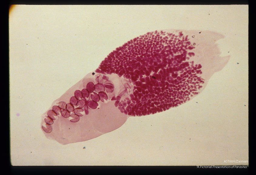 Strigeid trematode from coyote in California.