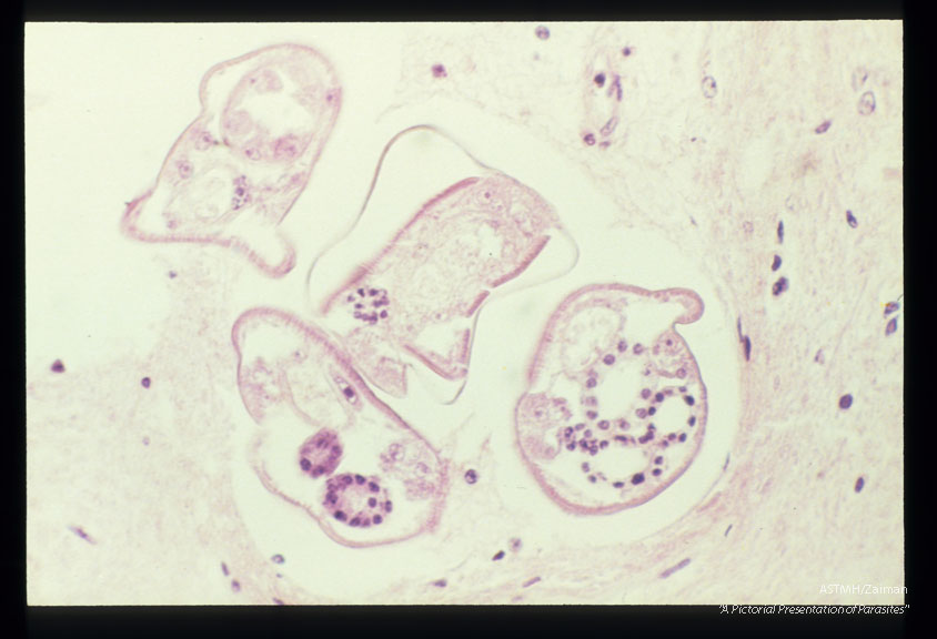 Longitudinal and cross-section of larvae in the spinal cord.