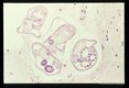Longitudinal and cross-section of larvae in the spinal cord.