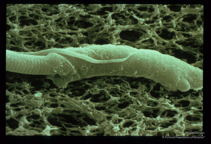 SEM showing melanin deposition around a microfilaria following inoculation into A. trivittatus.