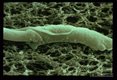 SEM showing melanin deposition around a microfilaria following inoculation into A. trivittatus.