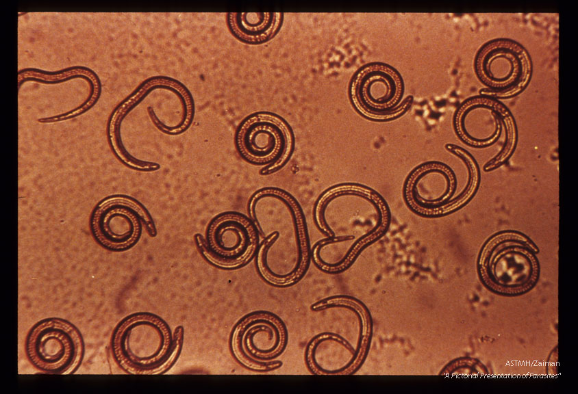 Muscle larvae. Isolated by pepsin digestion.