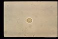 Uninucleate lemon shaped cyst, iodine stained.