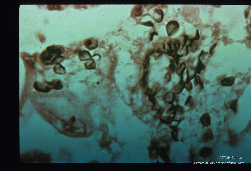 Section of lung stained with Gomori's methenamine-silver nitrate.