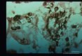 Section of lung stained with Gomori's methenamine-silver nitrate.