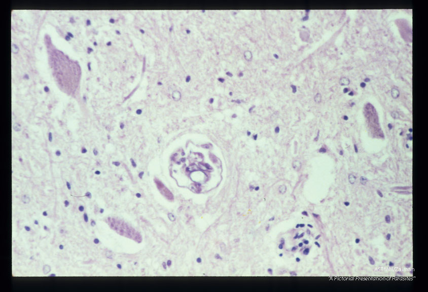 Longitudinal and cross-section of larvae in the spinal cord.