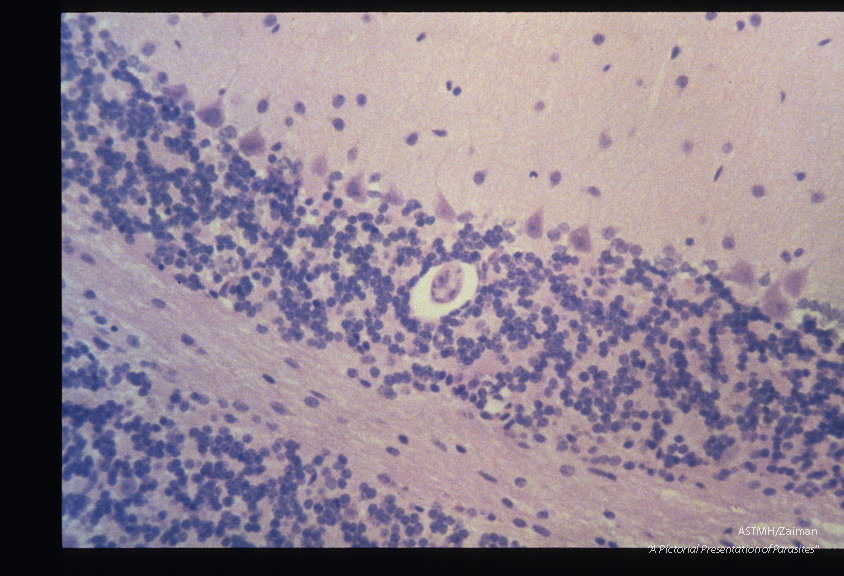 Mouse, BALB/c-Experimental infection as in 1957. CNS. At 8 months PI a larva is present within the granular layer of the cerebellum. Note the lack of inflammatory reaction. HE, x 200.