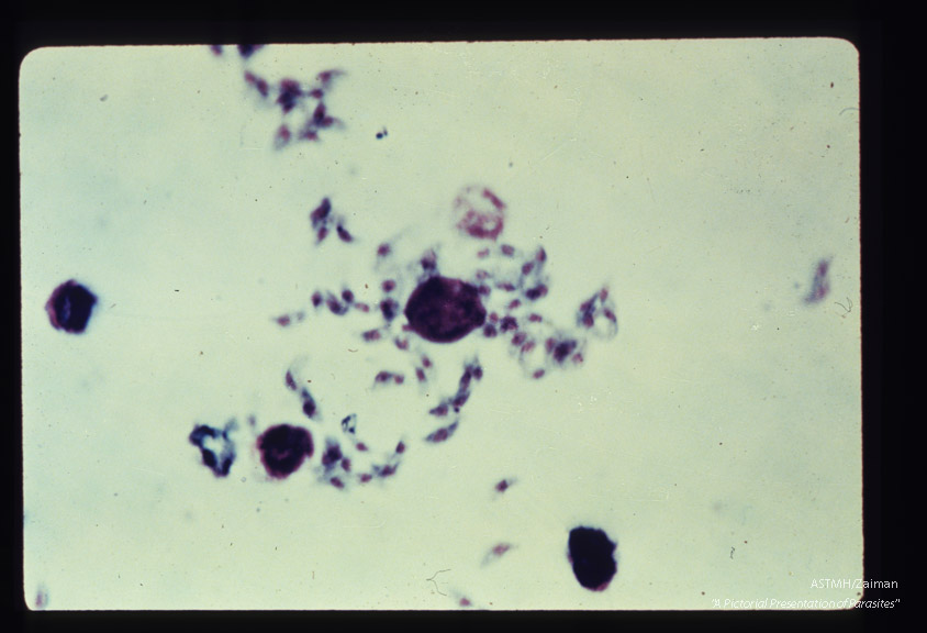 Motile forms from mouse peritoneum.