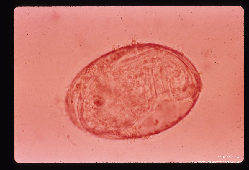 Egg containing a fully grown miracidium.