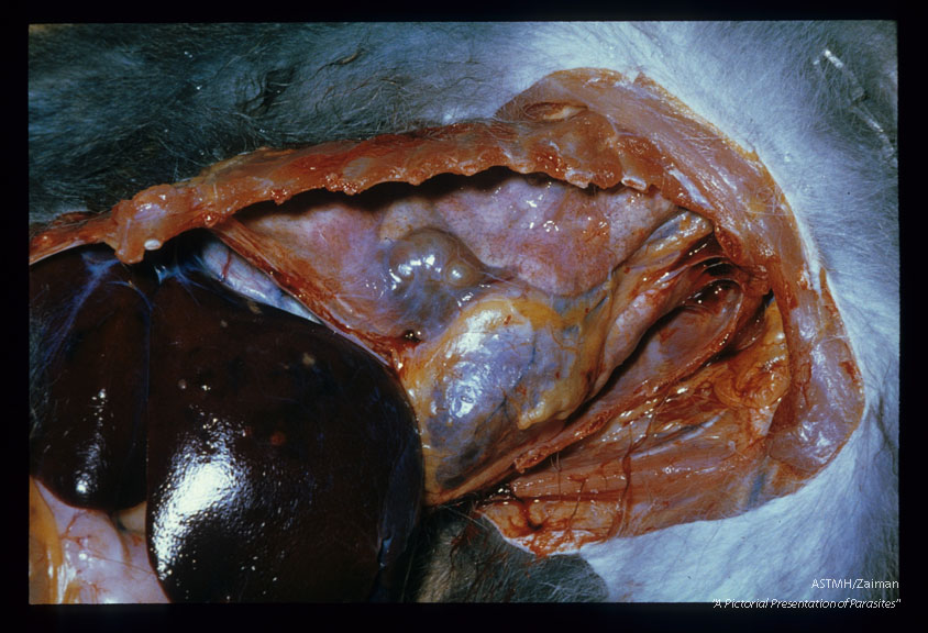 A large pulmonary cyst containing several adults is present Numerous eggs are present on the liver surface.