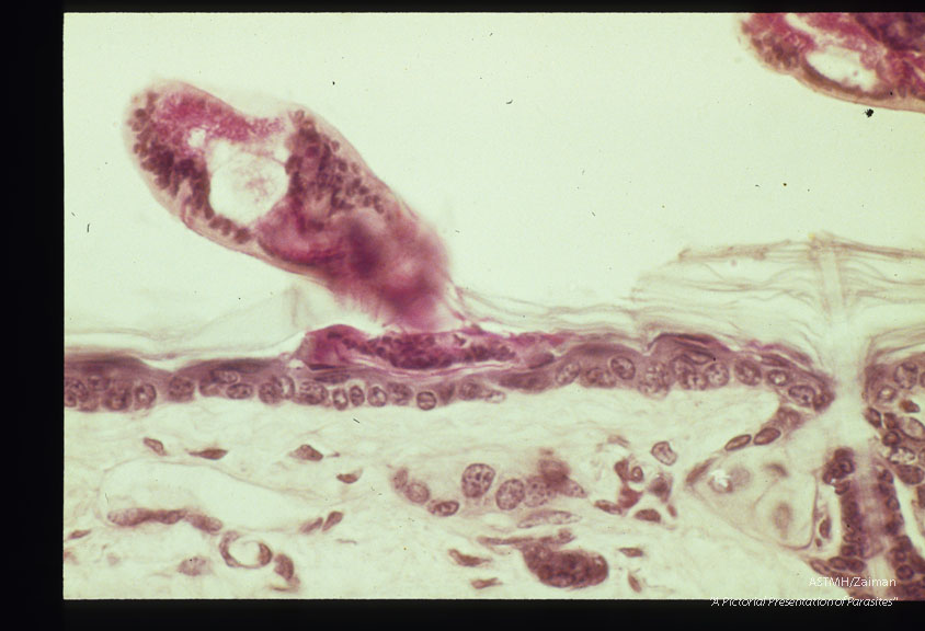 Cercariae before and after skin penetration. These slides compliment slides 1258 through 1262.