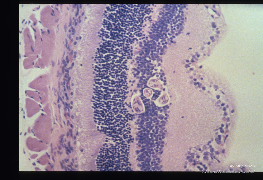 Mouse, BALB/c-Experimental infection as in 1955. Eye. At 15 days PI a coiled larva can be seen within the inner granular layer of the retina. Note the lack of inflammatory response. HE, x 200.