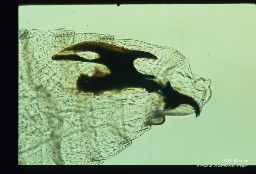 Cephalopharyngeal sclerite of second instar larva from same case.