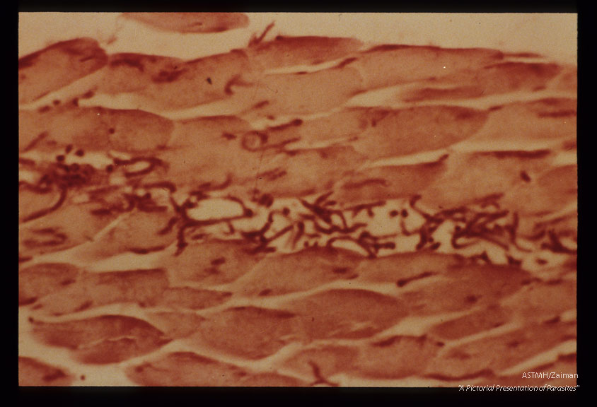 H & E stained section of muscle injected 10 minutes earlier with newborn larvae.