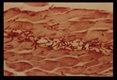 H & E stained section of muscle injected 10 minutes earlier with newborn larvae.