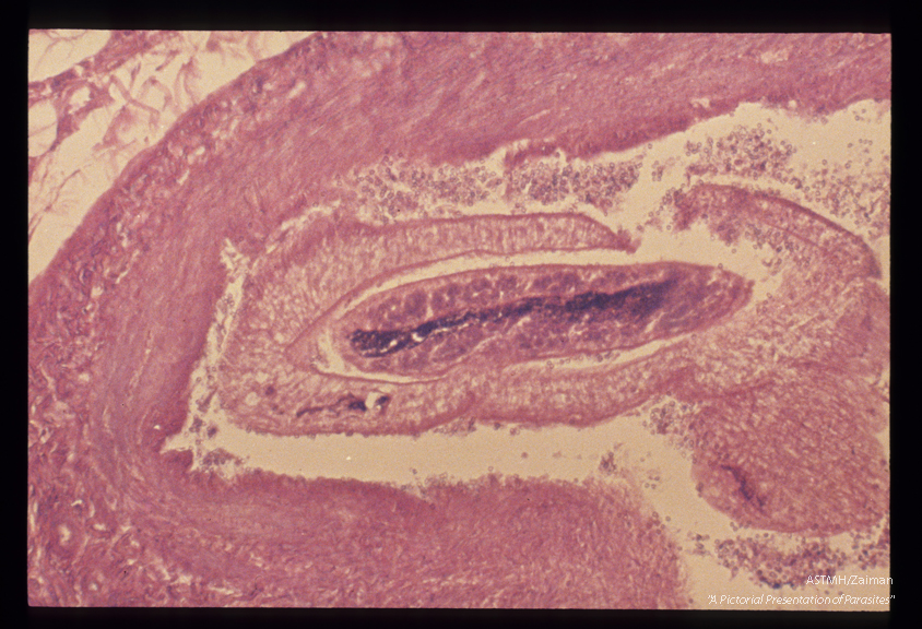 Adults in a mesenteric vein shownat greater magnification.