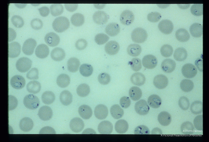 Multiple blood smears from experimental animals infected with material derived from human case.