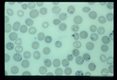 Multiple blood smears from experimental animals infected with material derived from human case.