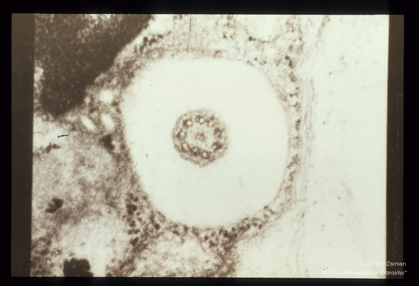 A single specimen showing cross section through a flagellum.