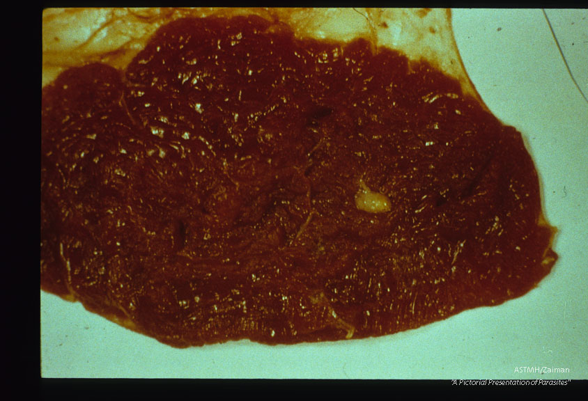 Cysticerci in beef voluntary muscle.