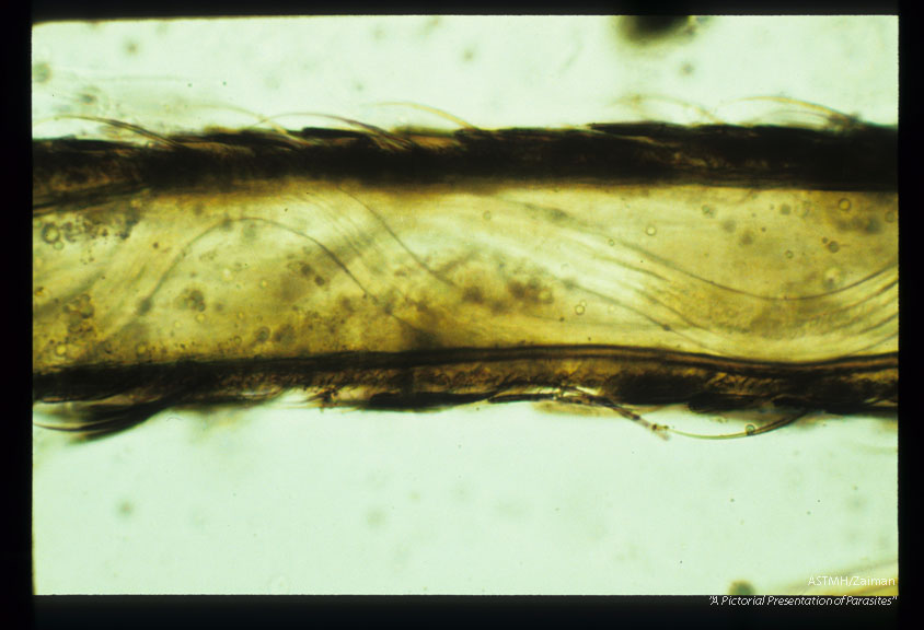 Larvae (L3) in Aedes aegypti proboscis.