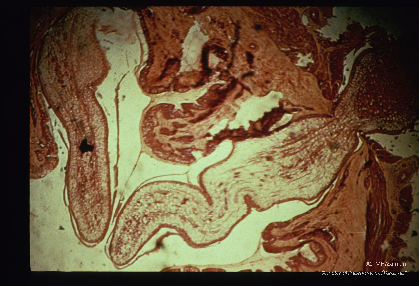 Sparganum perforating cat gut.