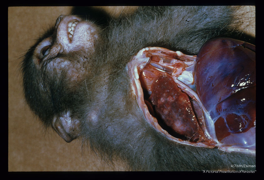 Pulmonary cysts, in a Taiwanese monkey, containing an adult Paragonimus.