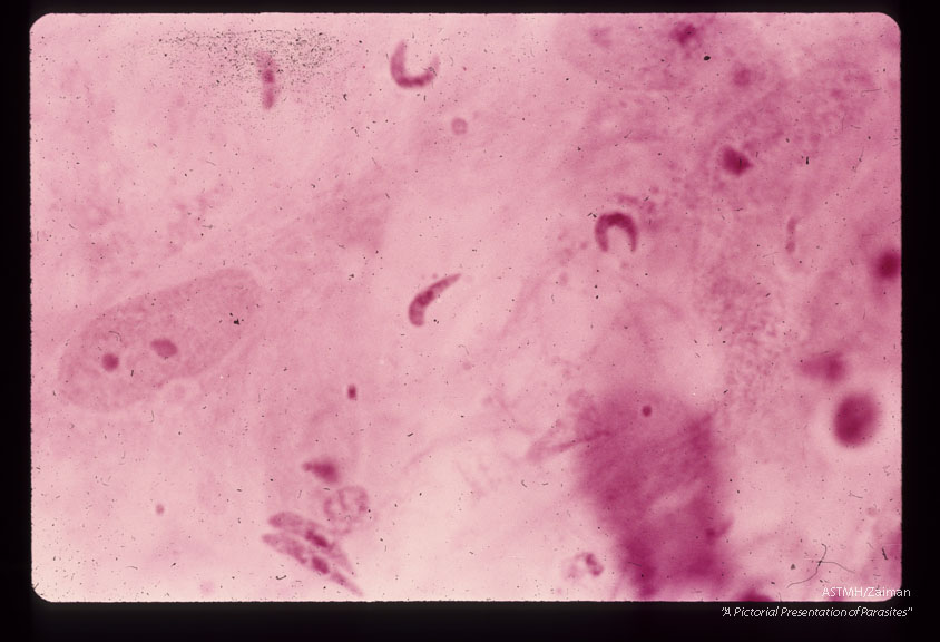 Free second-generation merozoites. H &E stain. (120 hr).