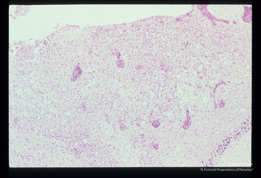 Cerebellum of an experimentally infected hamster showing perivascular cuffing, encephalitis, malacia and necrosis.