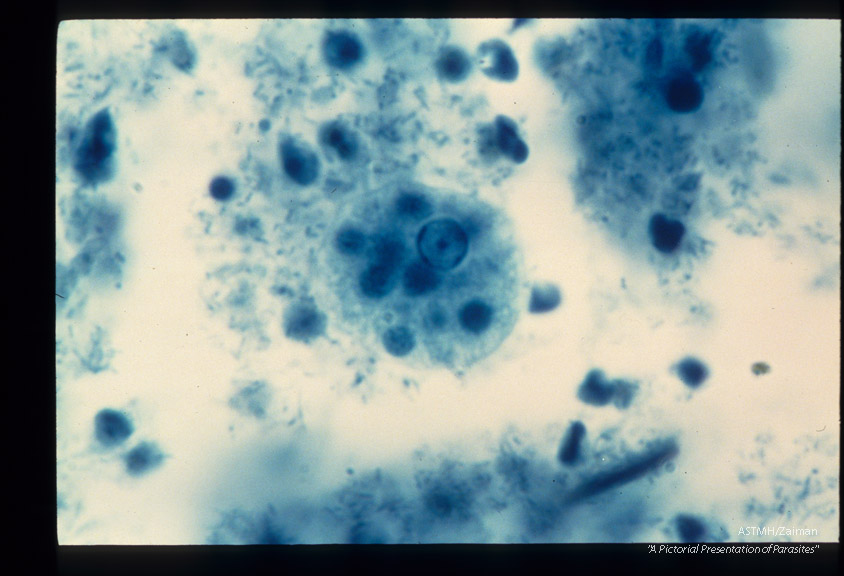 Trophozoite with ingested red blood cells.