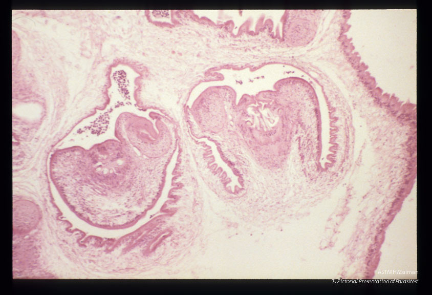 Multiple sections showing membranes, suckers and hooks.