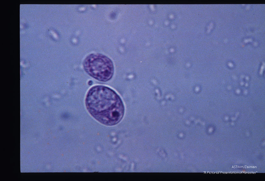 Cyst. MIF stain.