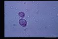 Cyst. MIF stain.