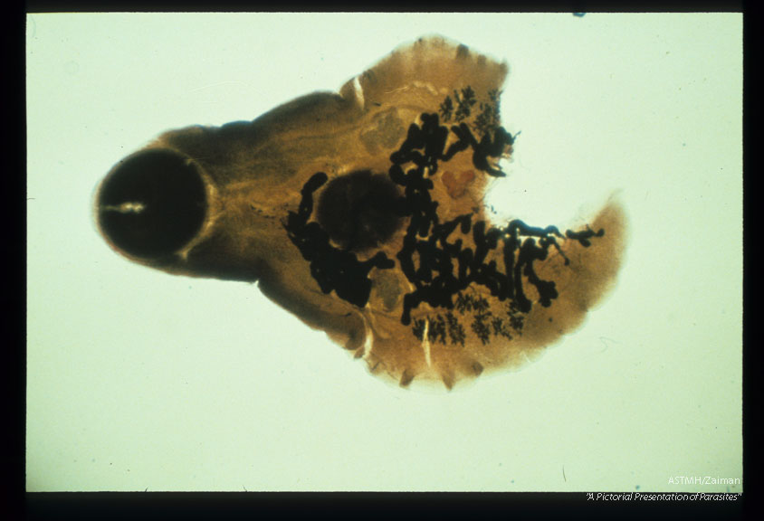 Adult trematode found in human pancreatic duct. Posterior amputated during dig section.