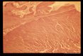 Granulomatous reaction around eggs in pericardium.
