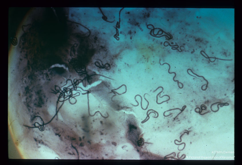 An iron haematoxylin preparation of the tissues of Simulium naevi showing developing larvae of Onchocera volvulus. Lower power view stained with iron haematoxylin.