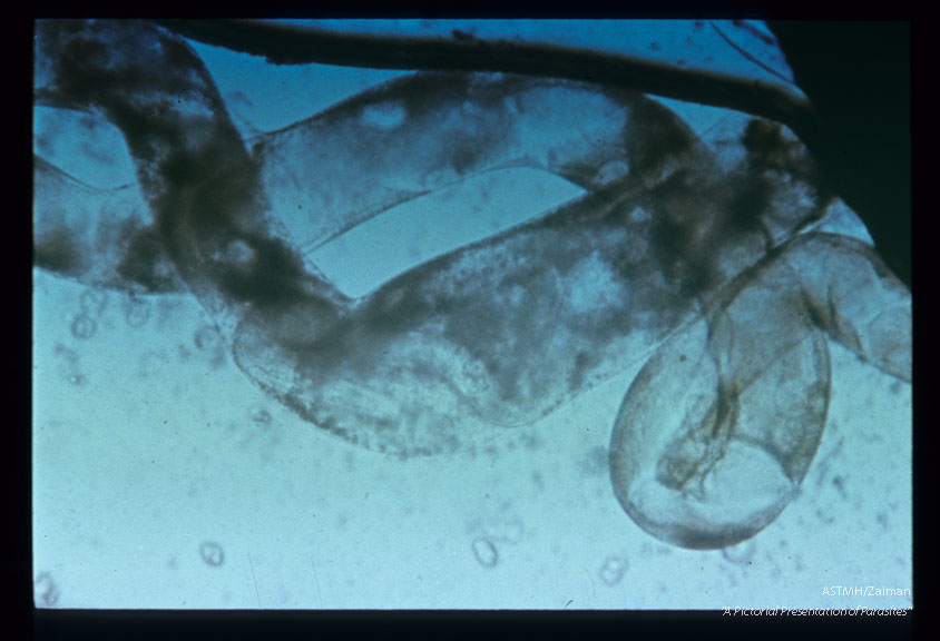 Larvae in the malpigian tube, 12 days after ingestion by Aedes togoi.